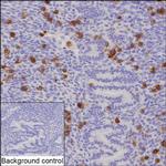 KIR2DL1 Recombinant Rabbit Monoclonal Antibody (K03_1J64)