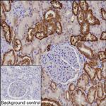 CDH16 Recombinant Rabbit Monoclonal Antibody (K03_1J79)