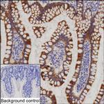 PRAP1 Recombinant Rabbit Monoclonal Antibody (K03_1J08)