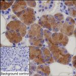 LACRT Antibody in Immunohistochemistry (Paraffin) (IHC (P))
