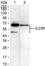 IL23R Recombinant Rabbit Monoclonal Antibody (K03_1K44)