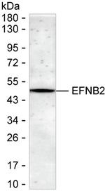 Ephrin B2 Recombinant Rabbit Monoclonal Antibody (K03_1K31)