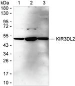 KIR3DL2 Recombinant Rabbit Monoclonal Antibody (K03_1J73)