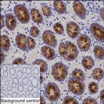 TFF1 Recombinant Rabbit Monoclonal Antibody (K03_1K15)