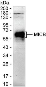 MICB Antibody in Western Blot (WB)