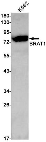 BAAT1 Antibody in Western Blot (WB)