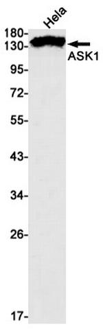 ASK1 Recombinant Rabbit Monoclonal Antibody (K01_1N12)