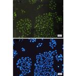 CRYAB Recombinant Rabbit Monoclonal Antibody (K01_1M64)