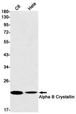 CRYAB Antibody in Western Blot (WB)