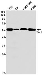 PAH Recombinant Rabbit Monoclonal Antibody (K01_1K84)