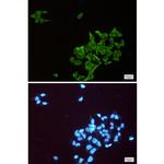 ENO1 Antibody in Immunocytochemistry (ICC/IF)