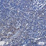 ENO1 Antibody in Immunohistochemistry (Paraffin) (IHC (P))