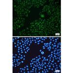 BAD Recombinant Rabbit Monoclonal Antibody (K01_1N38)