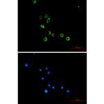 TLR2 Recombinant Rabbit Monoclonal Antibody (K01_1M09)