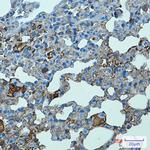TLR2 Antibody in Immunohistochemistry (Paraffin) (IHC (P))