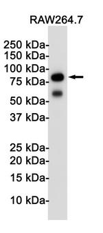 TLR2 Antibody in Western Blot (WB)