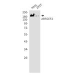ARFGEF2 Recombinant Rabbit Monoclonal Antibody (K01_1M99)
