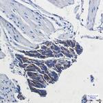 ATP1B1 Recombinant Rabbit Monoclonal Antibody (K01_1N25)