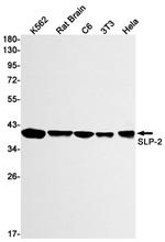STOML2 Antibody in Western Blot (WB)