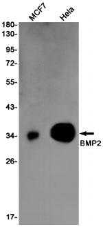 BMP-2 Recombinant Rabbit Monoclonal Antibody (K01_1N59)