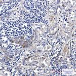 ARTS1 Recombinant Rabbit Monoclonal Antibody (K01_1N08)