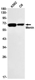Menin Recombinant Rabbit Monoclonal Antibody (K01_1K75)
