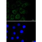 Caveolin 2 Recombinant Rabbit Monoclonal Antibody (K01_1N98)