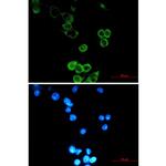 ATG5 Recombinant Rabbit Monoclonal Antibody (K01_1M90)