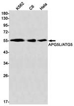 ATG5 Antibody in Western Blot (WB)