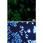 FDFT1 Recombinant Rabbit Monoclonal Antibody (K01_1L14)