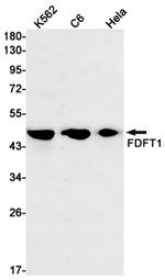 FDFT1 Antibody in Western Blot (WB)