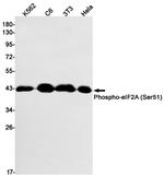 Phospho-EIF2S1 (Ser51) Recombinant Rabbit Monoclonal Antibody (K01_1L79)
