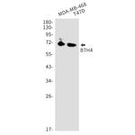 B7-H4 Recombinant Rabbit Monoclonal Antibody (K01_1N36)