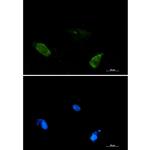 BIN1 Recombinant Rabbit Monoclonal Antibody (K01_1N56)