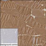 BIN1 Antibody in Immunohistochemistry (Paraffin) (IHC (P))