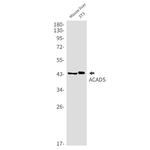 ACADS Antibody in Western Blot (WB)