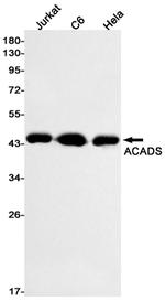 ACADS Antibody in Western Blot (WB)