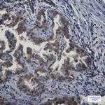 APPL1 Antibody in Immunohistochemistry (Paraffin) (IHC (P))
