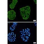 Annexin A6 Recombinant Rabbit Monoclonal Antibody (K01_1M79)