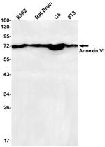 Annexin A6 Antibody in Western Blot (WB)