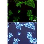 WARS Recombinant Rabbit Monoclonal Antibody (K01_1K53)