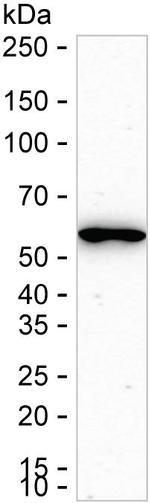 WARS Antibody in Western Blot (WB)