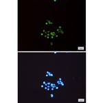 MCM3 Recombinant Rabbit Monoclonal Antibody (K01_1K35)