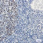MCM3 Antibody in Immunohistochemistry (Paraffin) (IHC (P))