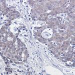 NEDD8 Antibody in Immunohistochemistry (Paraffin) (IHC (P))