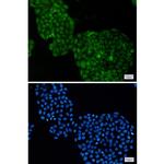 ADRM1 Recombinant Rabbit Monoclonal Antibody (K01_1M44)