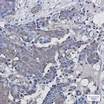 ADRM1 Antibody in Immunohistochemistry (Paraffin) (IHC (P))