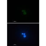 MATR3 Recombinant Rabbit Monoclonal Antibody (K01_1K40)