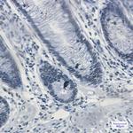 MATR3 Antibody in Immunohistochemistry (Paraffin) (IHC (P))