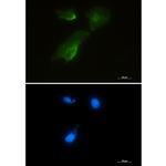 GOT1 Recombinant Rabbit Monoclonal Antibody (K01_1N13)